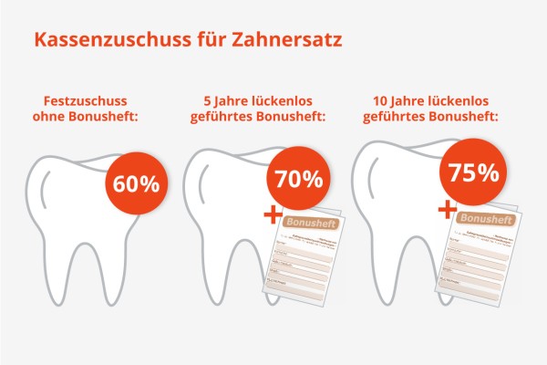 Bis zu 75 Prozent Zuschuss der Krankenkasse bei Zahnersatz mit Bonusheft